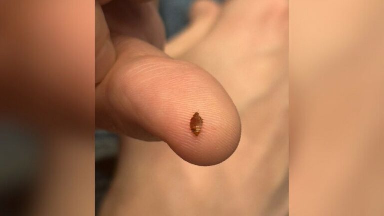 Infestation de punaises au cinéma : la colère monte